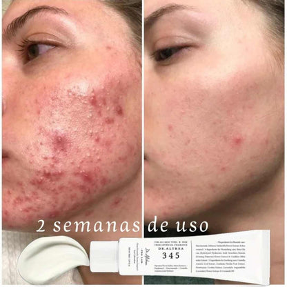 Dr. Althea 345 Relief Cream – Tu Piel Sin Manchas