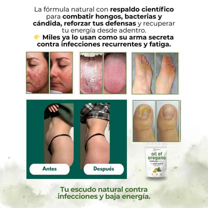 Aceite de Orégano – Tu Antibiótico Natural Poderoso 🌿