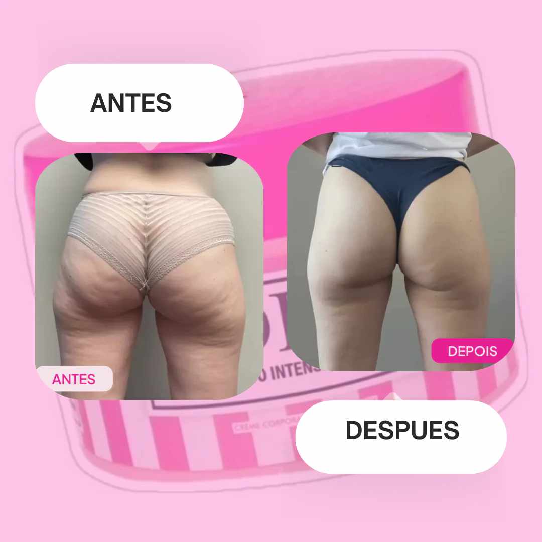 Crema Adeus  5 en 1 x 300g – Piel Firme y Sin Imperfecciones 💖