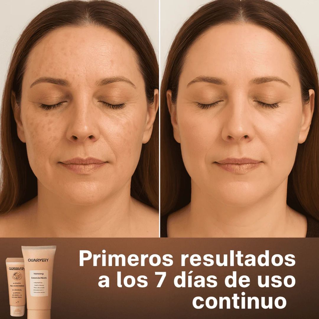 Quarxery Gel Exfoliante Aclarador 60g – Piel suave en zonas clave ✨