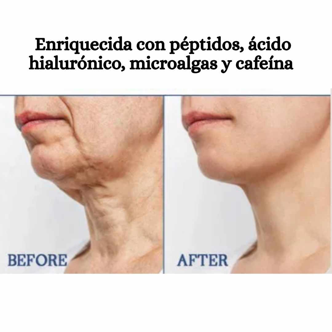Crema Reafirmante HOYGI 240ml – Efecto Lifting Sin Cirugía Ni Inyecciones 💉