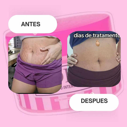 Crema Adeus  5 en 1 x 300g – Piel Firme y Sin Imperfecciones 💖