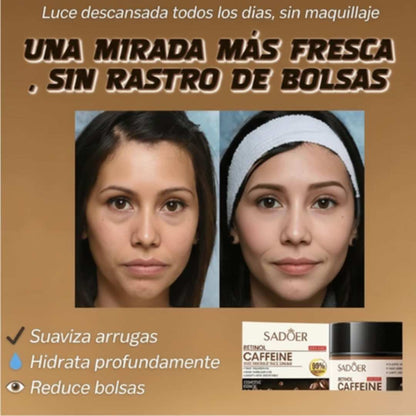 Contorno de Ojos Café & Retinol x 30g – Mirada Radiante 👁️✨