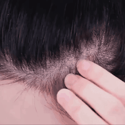 Corrector de Cabello Bunee - línea del cabello