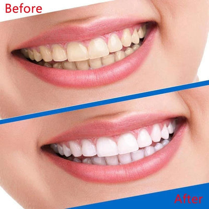PEGATINAS BLANQUEADORAS DE DIENTES
